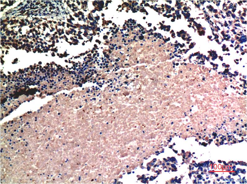 Anti-AKT Mouse mAb [91M99K94]