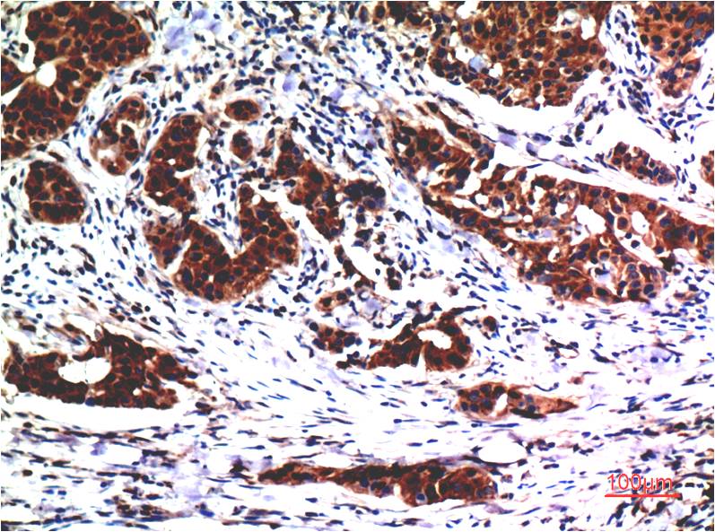 Anti-AKT Mouse mAb [91M99K94]