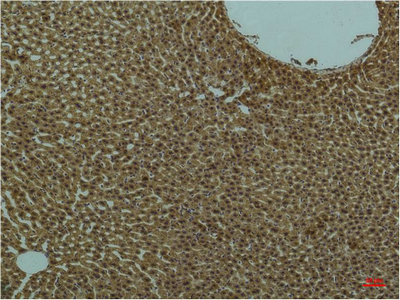 Anti-PI3 Kinase p85 alpha Mouse mAb [35L23K27]