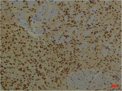 Anti-PI3 Kinase p85 alpha Mouse mAb [35L23K27]