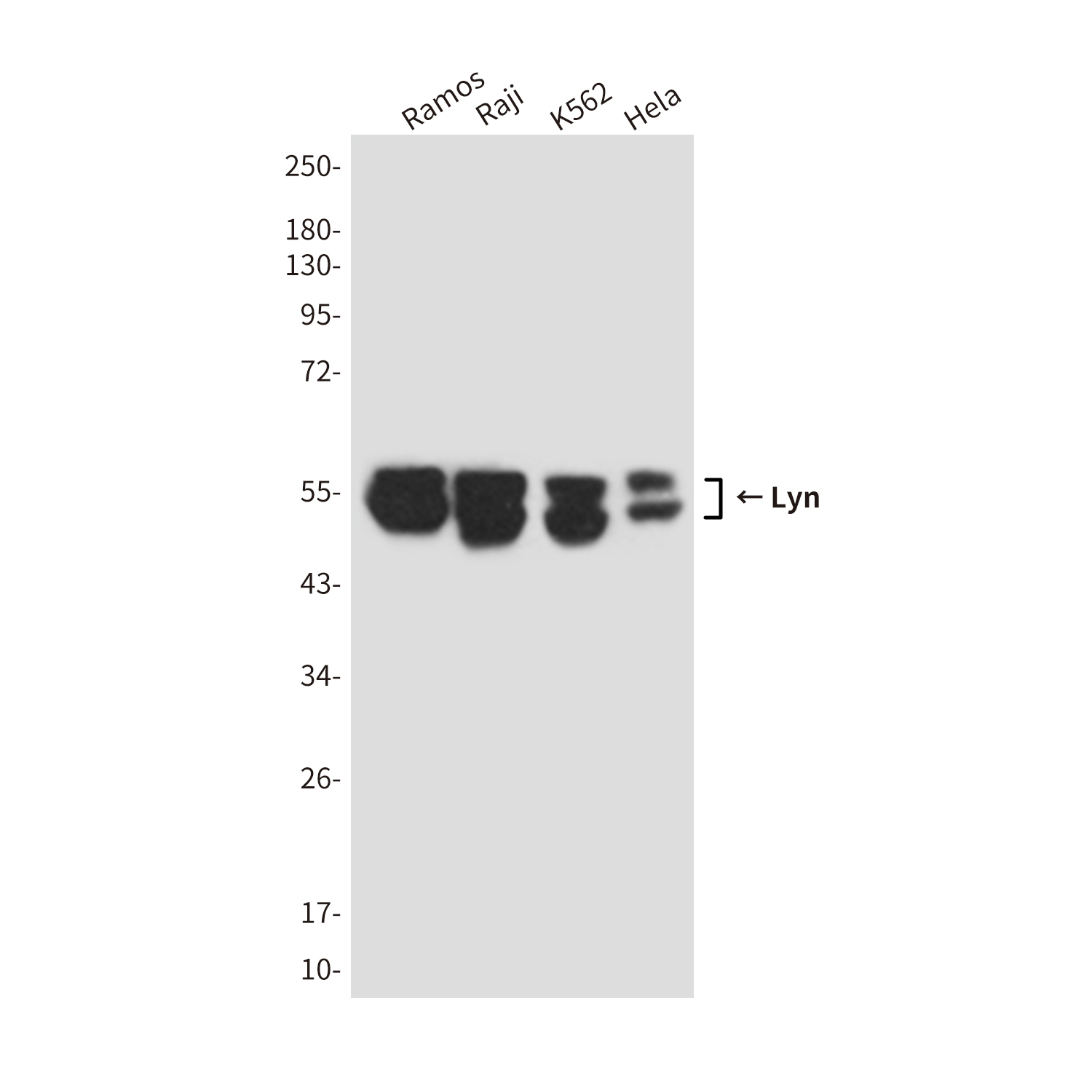Anti-Lyn Mouse mAb [27K94M01]