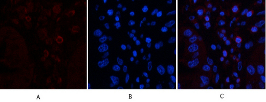 Anti-CD45 Mouse mAb [73K93K13]