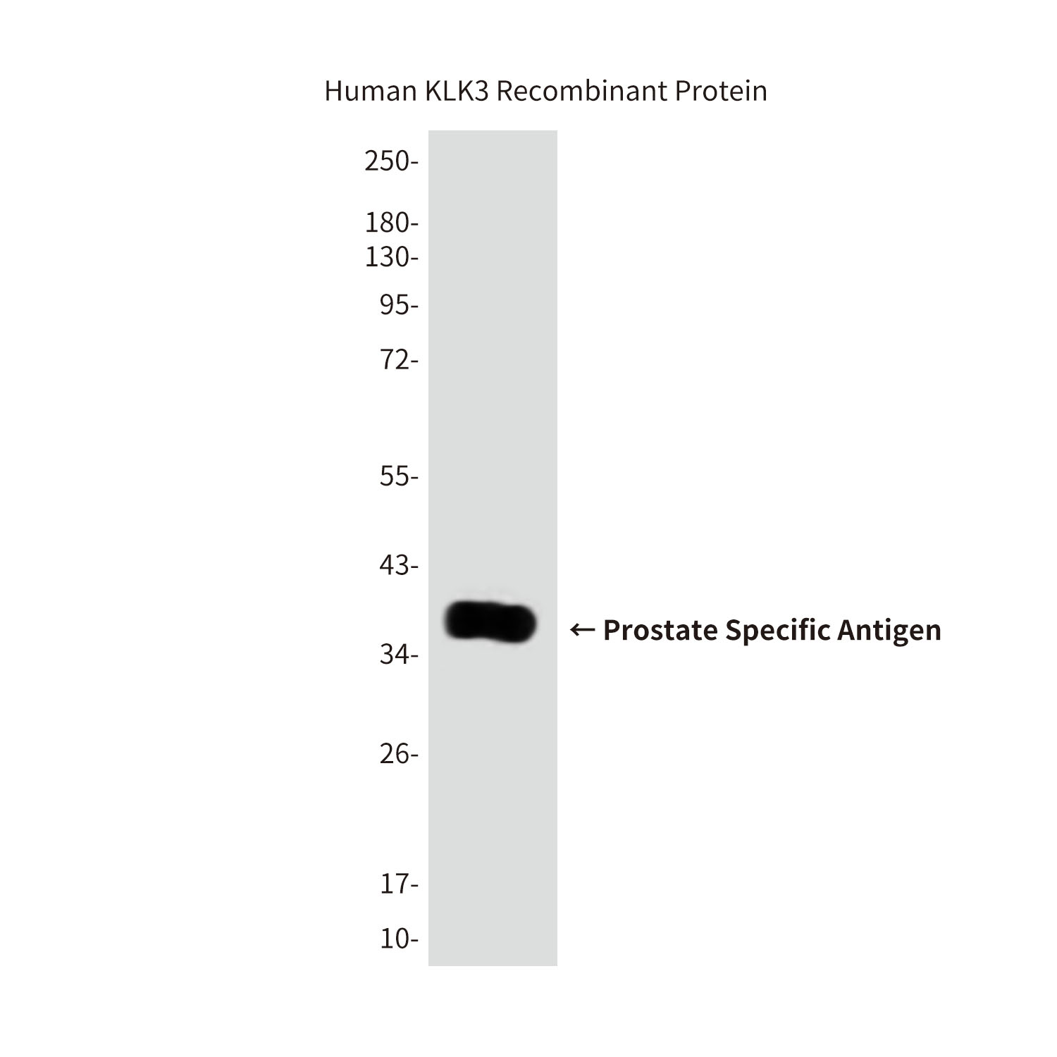 Anti-Prostate Specific Antigen Mouse mAb [25K33K47]