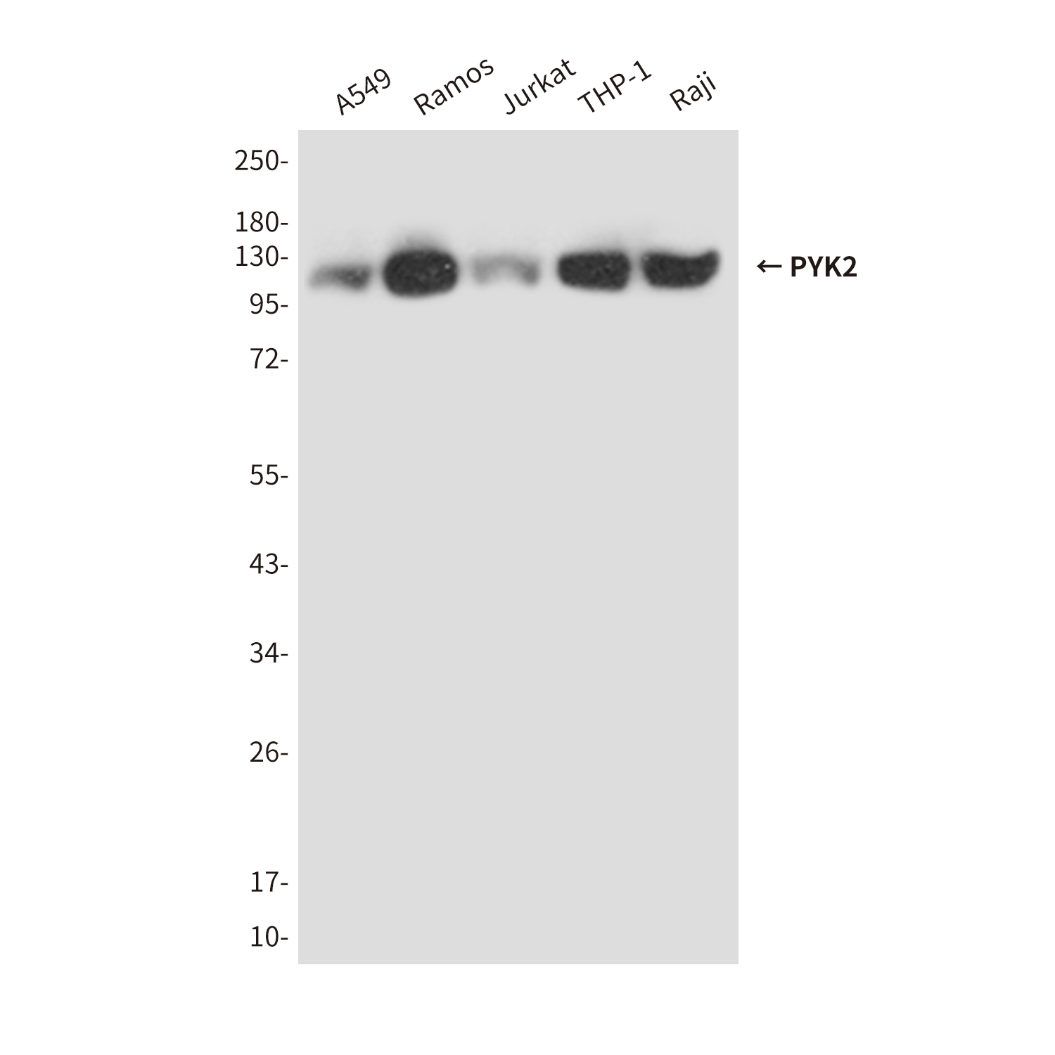 Anti-PYK2 Mouse mAb [91L08L93]
