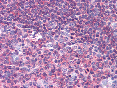 Anti-PYK2 Mouse mAb [91L08L93]
