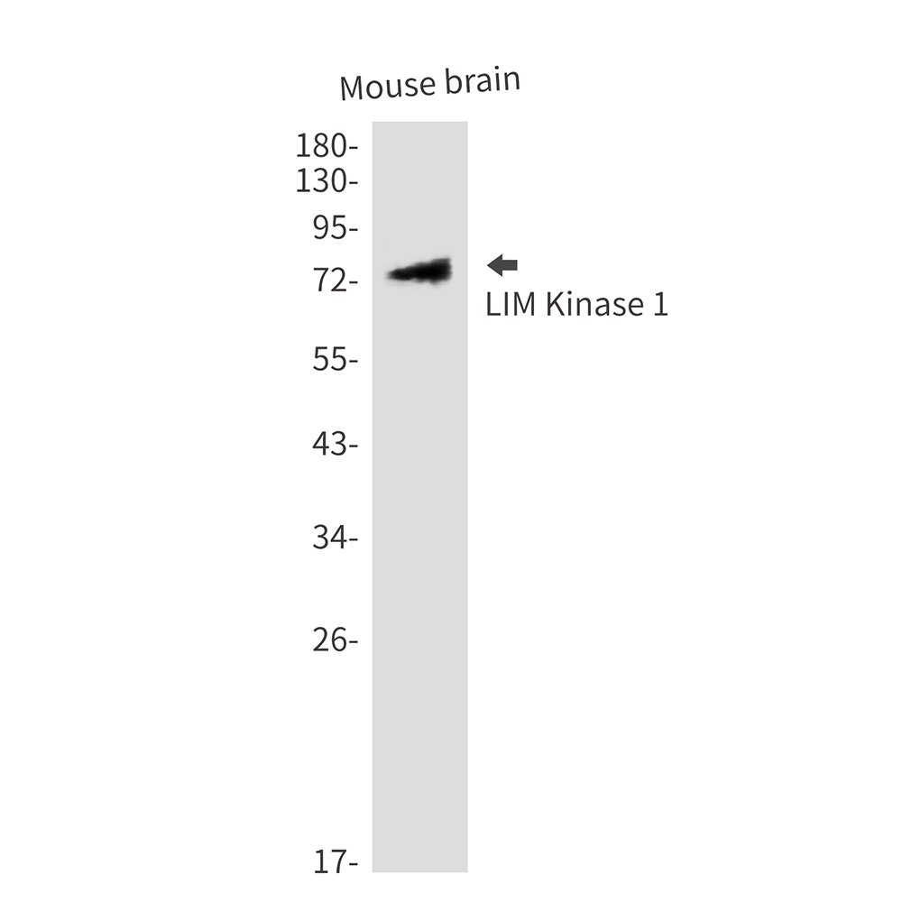 Anti-LIM Kinase 1 Rabbit pAb