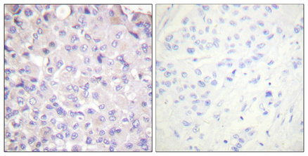 Anti-Phospho-IKK beta (Tyr188) Rabbit pAb