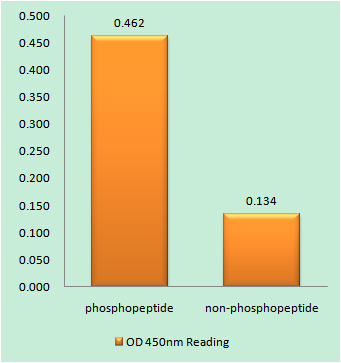 Anti-Phospho-IKK beta (Tyr188) Rabbit pAb
