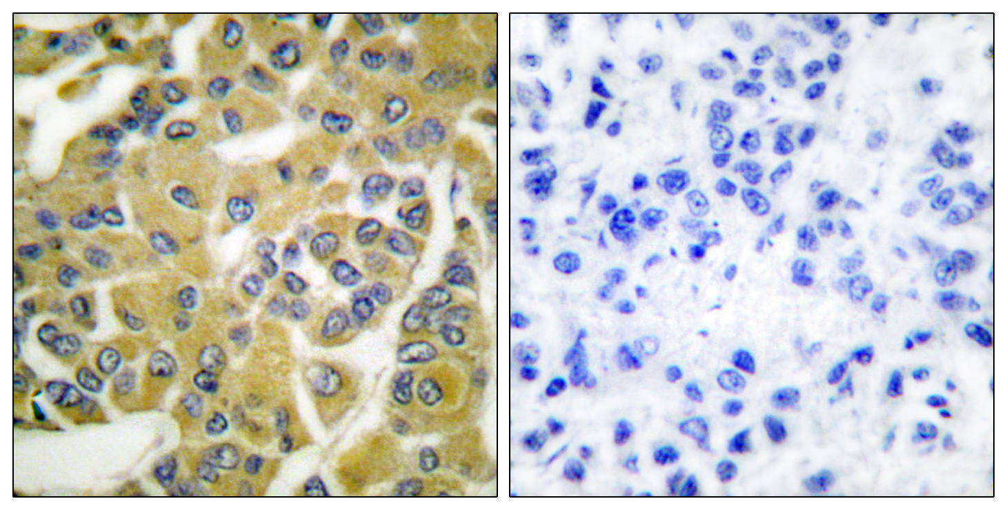 Anti-Phospho-IKK beta (Tyr188) Rabbit pAb