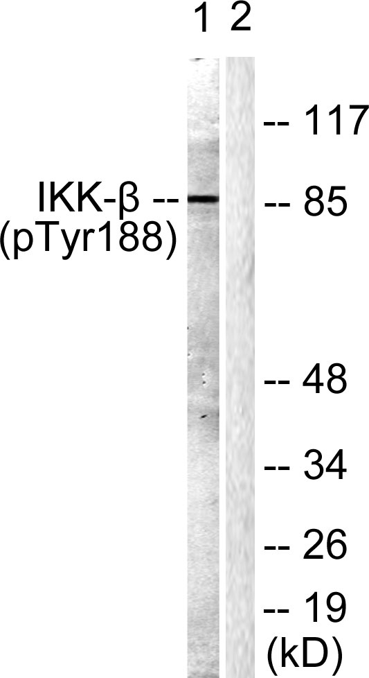Anti-Phospho-IKK beta (Tyr188) Rabbit pAb