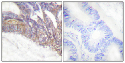Anti-Phospho-LAT (Tyr191) Rabbit pAb