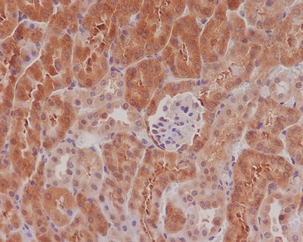 Anti-Phospho-eIF4E (Ser209) Rabbit pAb