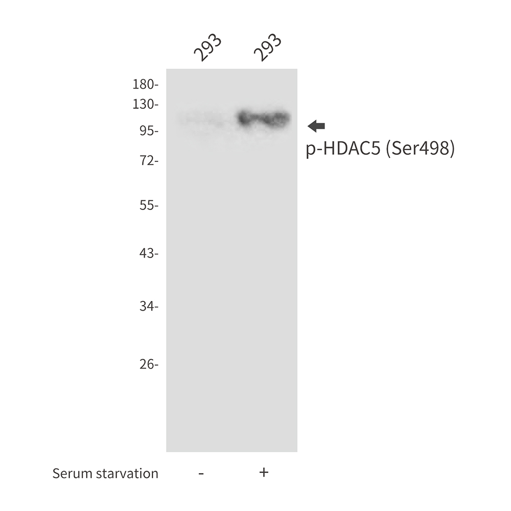 Anti-Phospho-HDAC5 (Ser498) Rabbit pAb