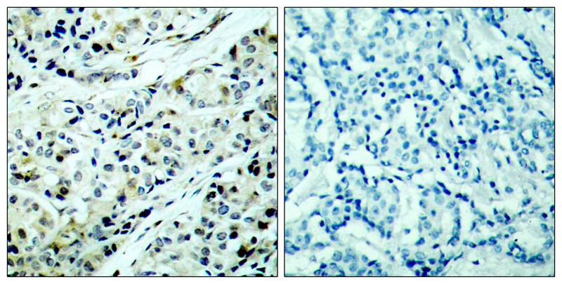 Anti-Phospho-HDAC5 (Ser498) Rabbit pAb