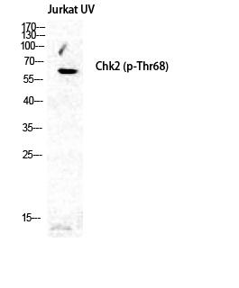 Anti-Phospho-Chk2 (Thr68) Rabbit pAb