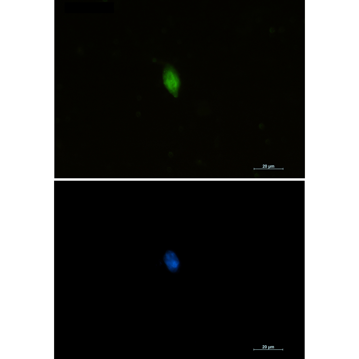 Anti-CDKN2A/p16INK4a Rabbit pAb