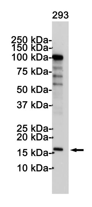 Anti-CDKN2A/p16INK4a Rabbit pAb