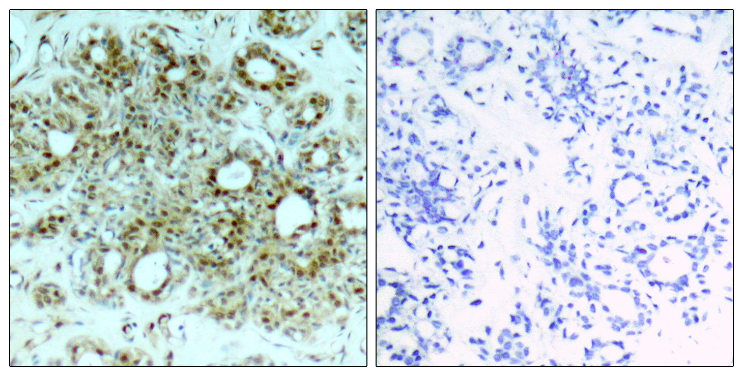 Anti-NF-KB p65 Rabbit pAb