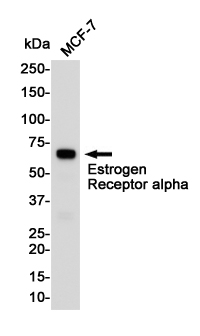 Anti-Estrogen Receptor alpha Rabbit pAb