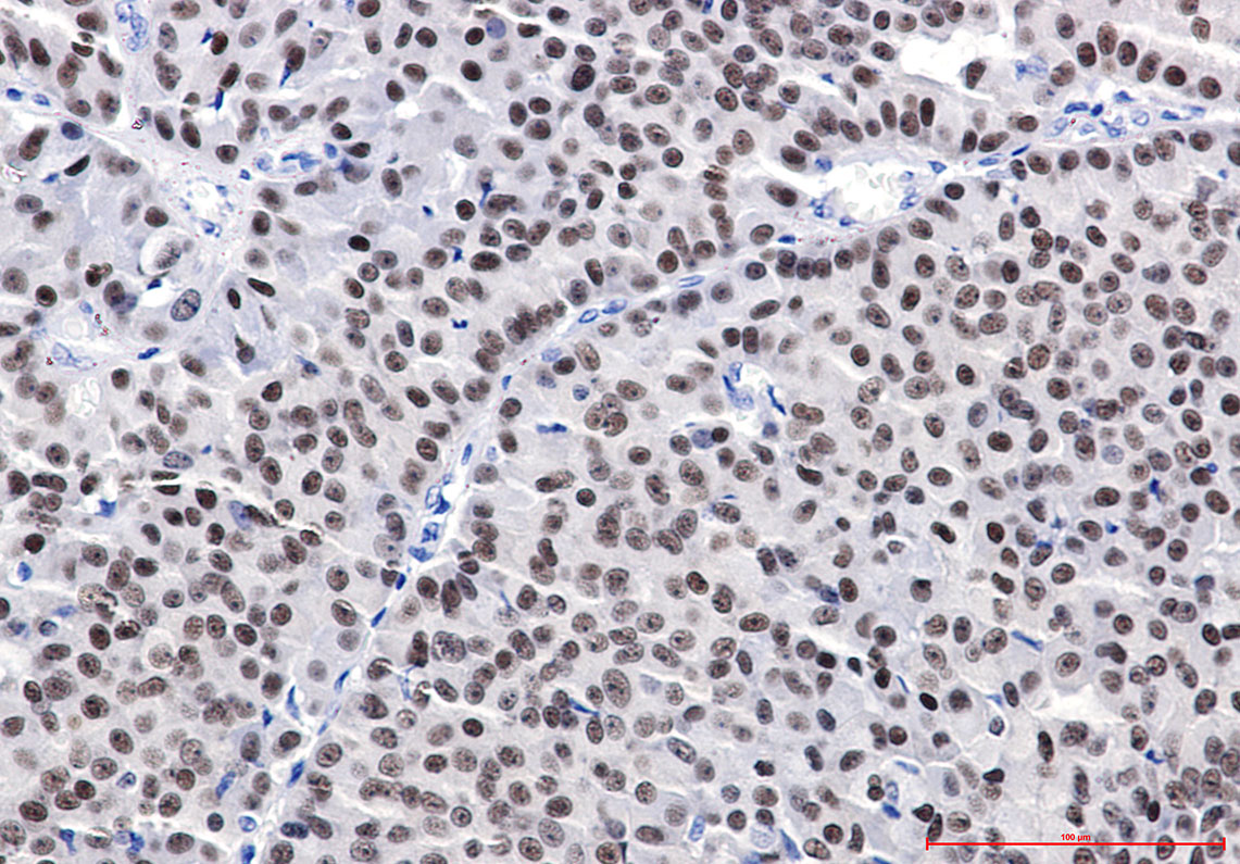 Anti-Estrogen Receptor alpha Rabbit pAb