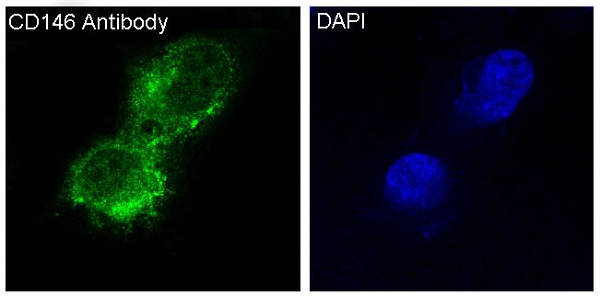 Anti-CD146 Rabbit pAb