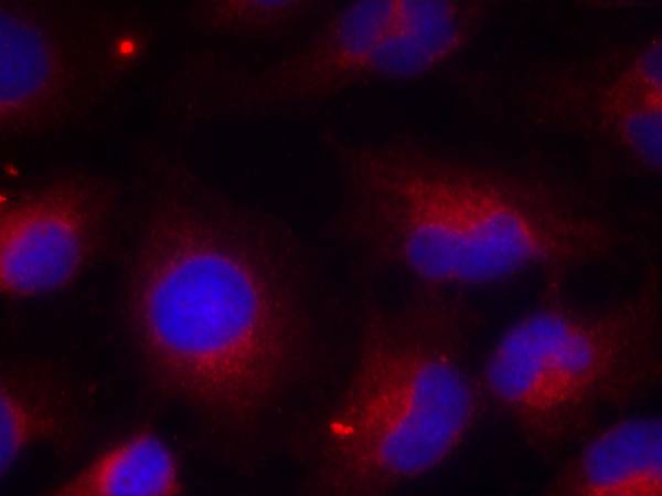Anti-Phospho-PTEN (Ser380) Rabbit pAb