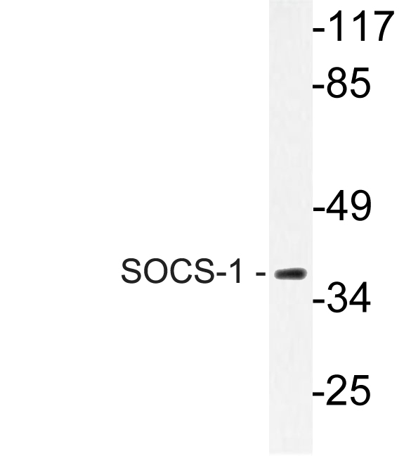 Anti-SOCS1 Rabbit pAb