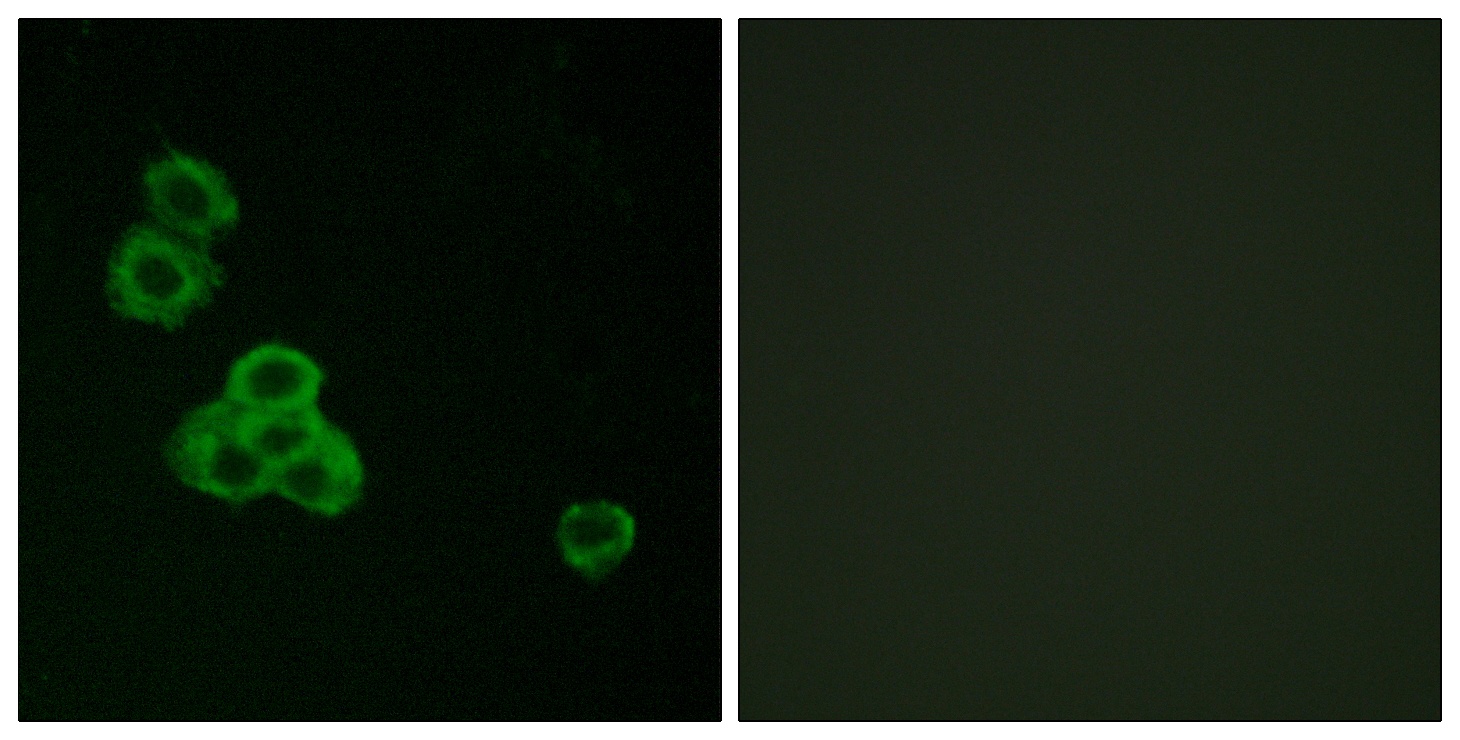 Anti-CaMKII alpha/delta Rabbit pAb