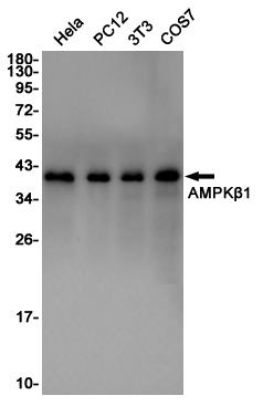 Anti-AMPK beta 1 Rabbit pAb