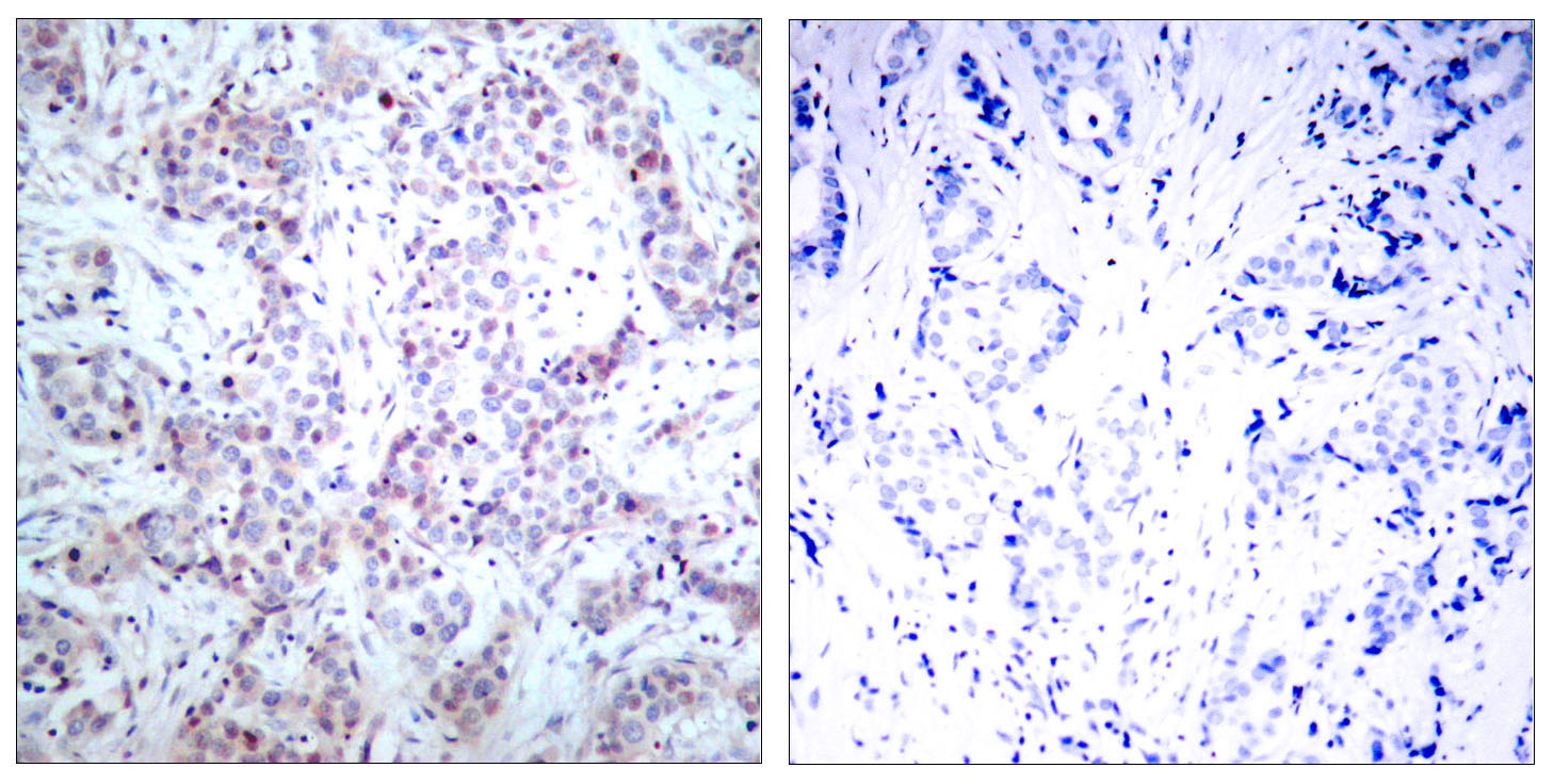 Anti-NF-KB p65 Rabbit pAb