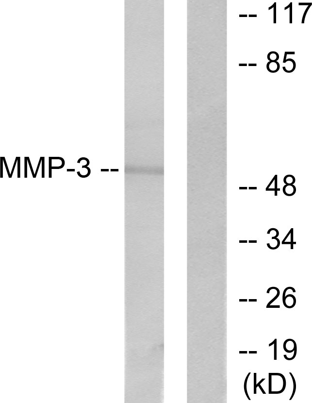Anti-MMP3 Rabbit pAb