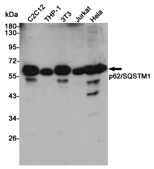 Anti-SQSTM1/p62 Rabbit pAb