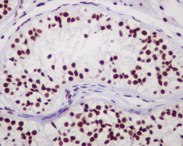 Anti-Chk2 Rabbit pAb