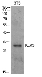 Anti-Prostate Specific Antigen Rabbit pAb