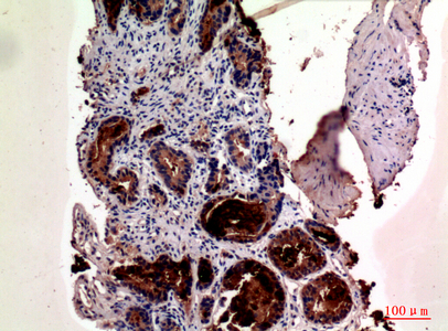 Anti-Prostate Specific Antigen Rabbit pAb