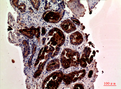Anti-Prostate Specific Antigen Rabbit pAb