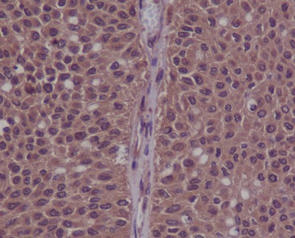 Anti-Phospho-CDK2 (Tyr15) Rabbit pAb