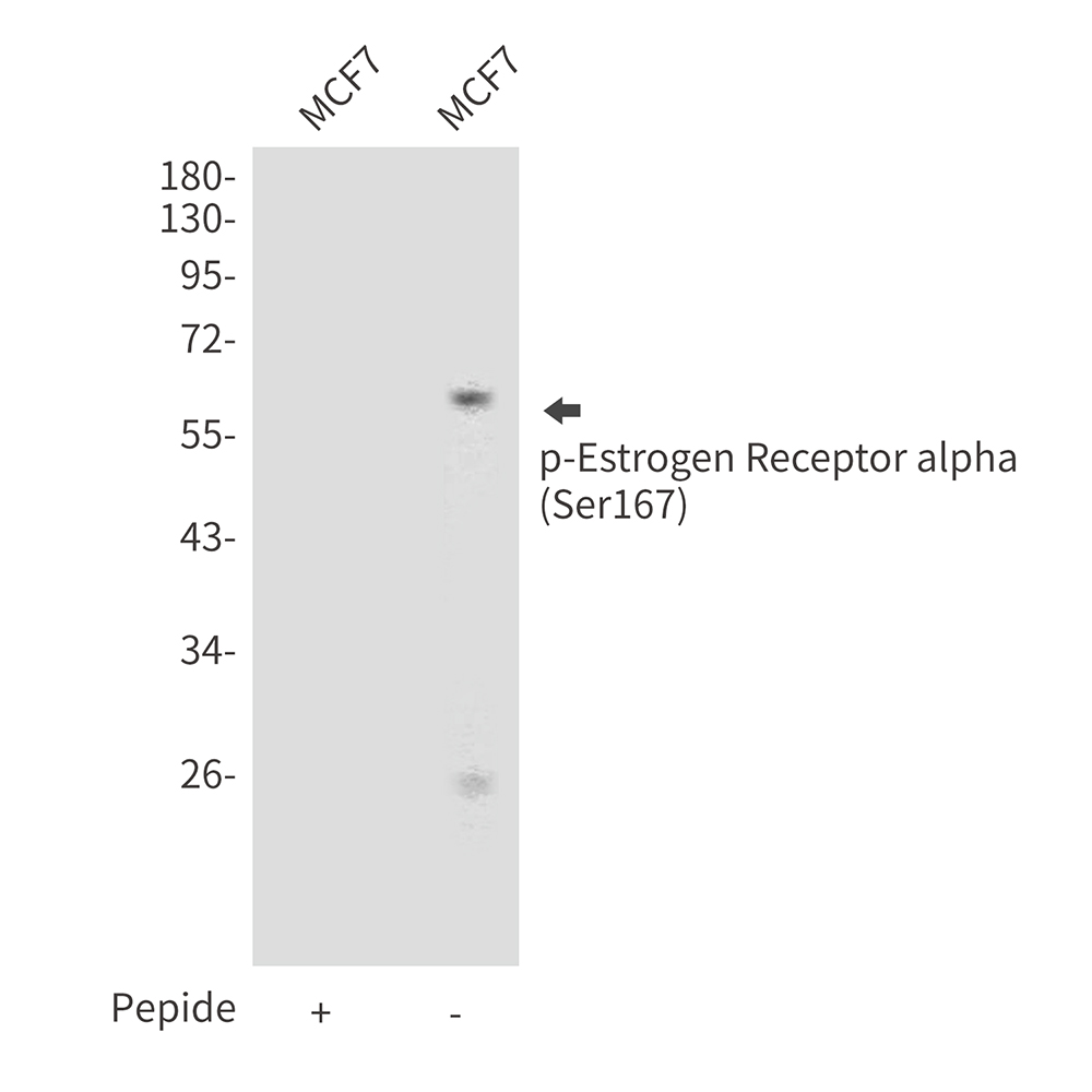 Anti-Phospho-Estrogen Receptor alpha (Ser167) Rabbit pAb