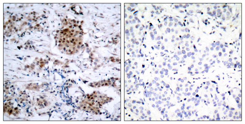 Anti-Phospho-Estrogen Receptor alpha (Ser167) Rabbit pAb