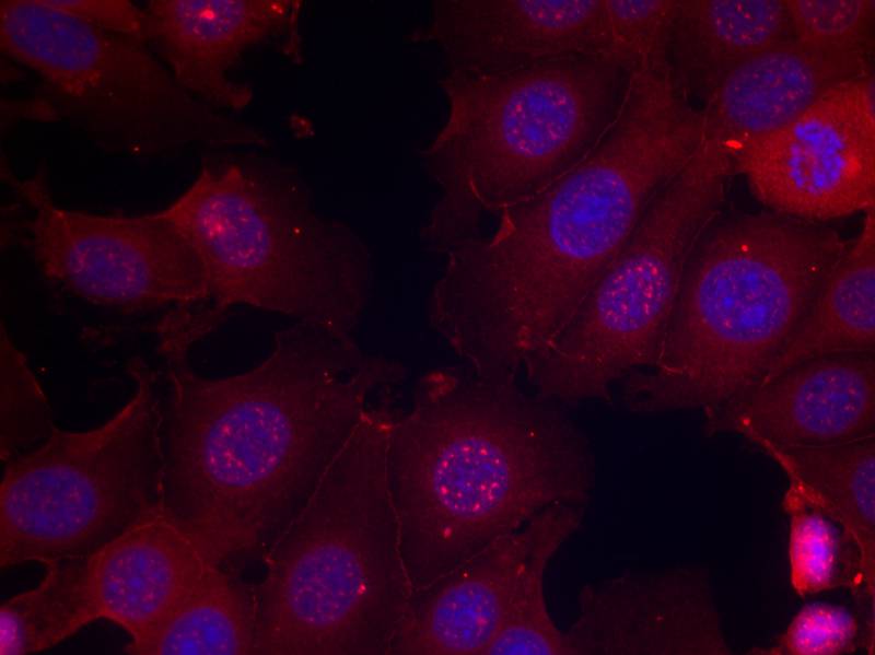 Anti-Phospho-Estrogen Receptor alpha (Ser167) Rabbit pAb