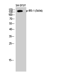 Anti-Phospho-IRS1 (Ser636) Rabbit pAb