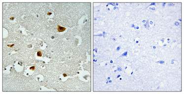 Anti-Phospho-IRS1 (Ser636) Rabbit pAb