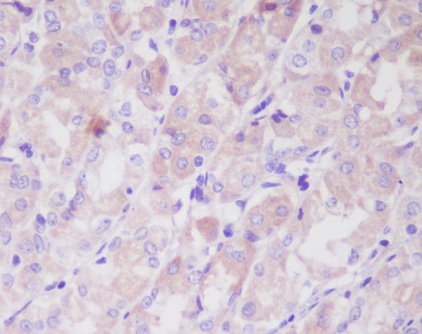 Anti-Integrin Linked ILK Rabbit pAb