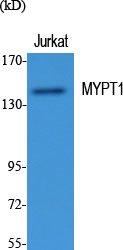 Anti-Myosin Phosphatase Rabbit pAb