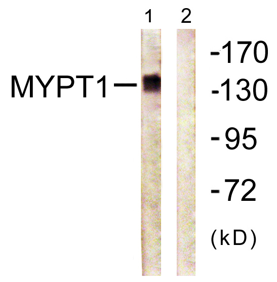 Anti-Myosin Phosphatase Rabbit pAb