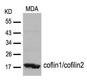 Anti-Cofilin Rabbit pAb
