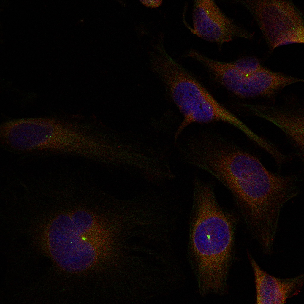 Anti-Cofilin Rabbit pAb