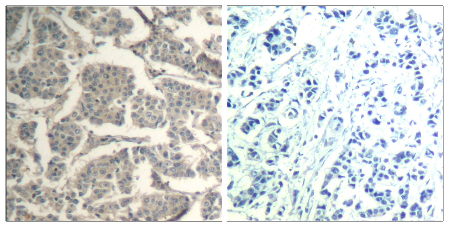 Anti-Cofilin Rabbit pAb