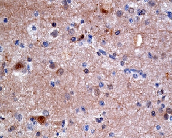 Anti-ATP Citrate lyase Rabbit pAb
