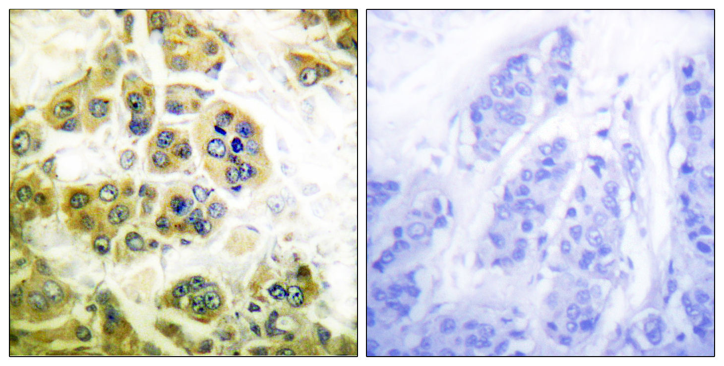 Anti-IKK alpha/beta Rabbit pAb